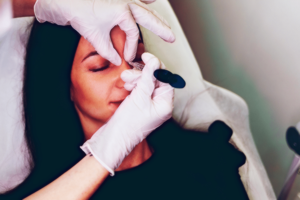 My Liquid Rhinoplasty (Nose Filler)